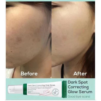Axis-Y Dark Spot Correcting Glow Serum - 50ml