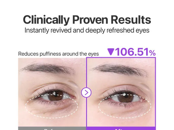 Numbuzin - No.9 NAD Collagen Under Eye Patches [5 Pairs]