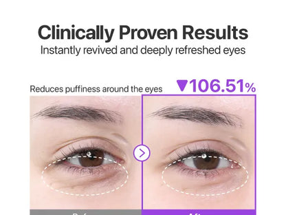 Numbuzin - No.9 NAD Collagen Under Eye Patches [5 Pairs]